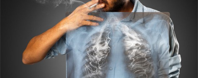 Man smoking with x-ray lung